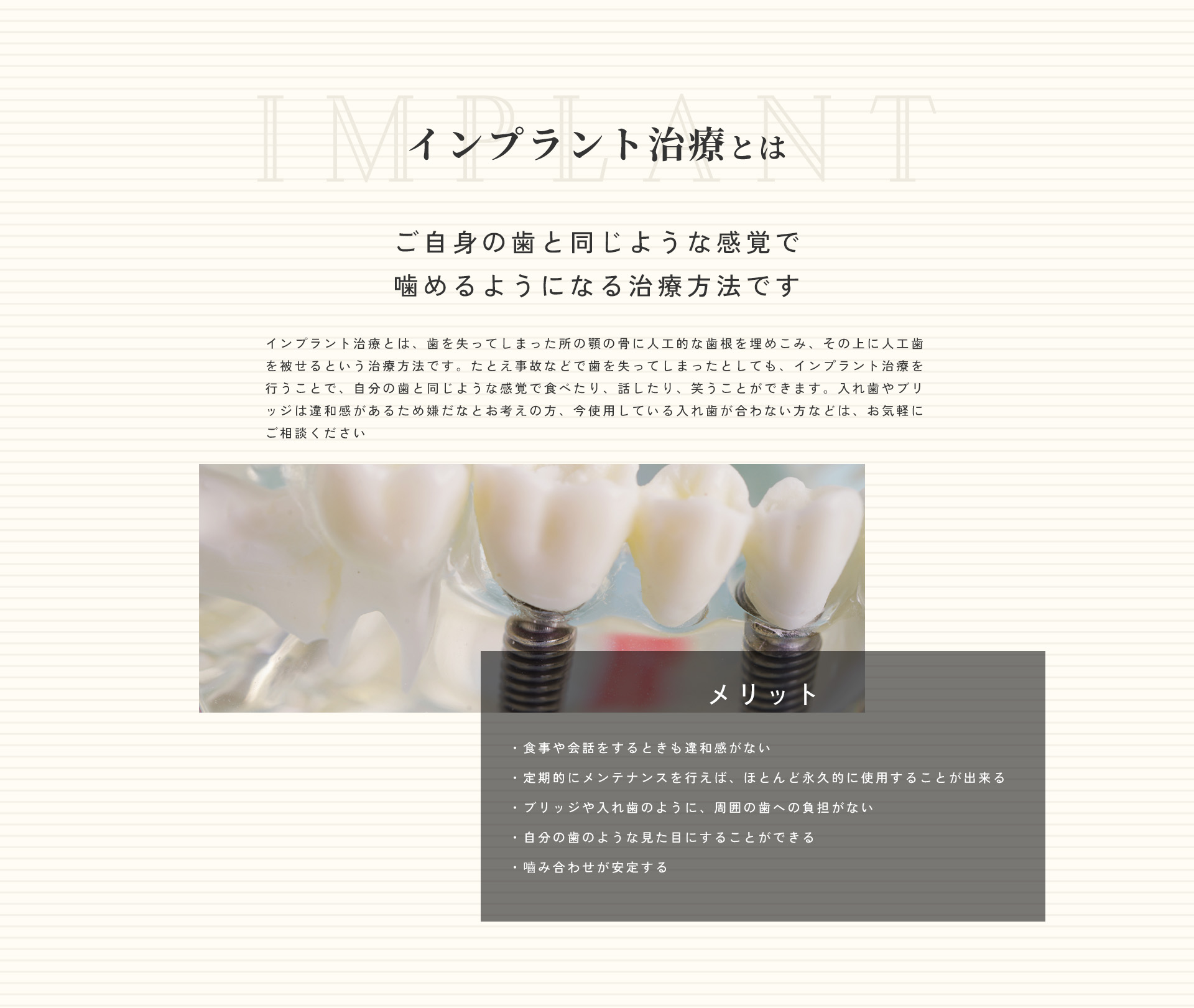 インプラント治療とは